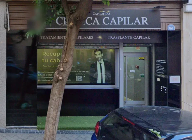 Capilando Clínica de Injerto Capilar Madrid