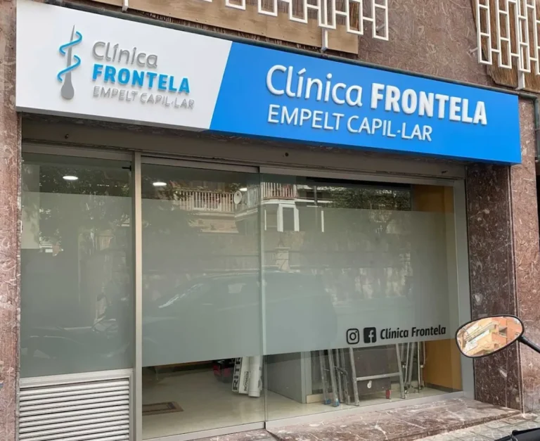 Clínica Frontela Barcelona - Injerto Capilar