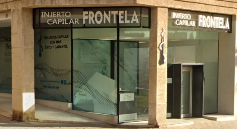Clínica Frontela Málaga - Injerto Capilar