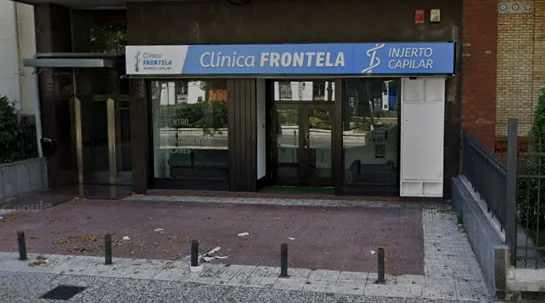 Clínica Frontela Zaragoza - Injerto Capilar