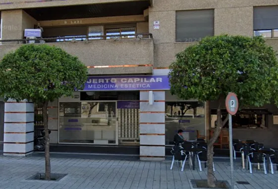 Clínica Serres capilar jerez de la frontera