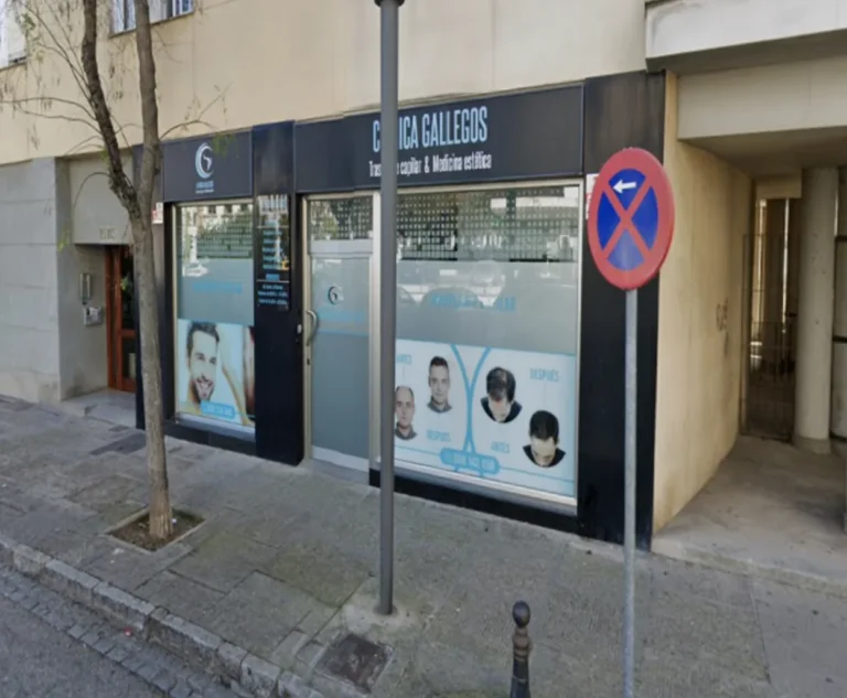 Clínica capilar Gallegos Jerez de la frontera