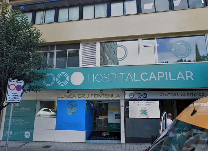 Hospital Capilar - Injerto Capilar en Pontevedra
