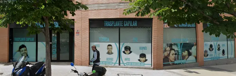 Clínica Gallegos | Clínica Capilar Madrid