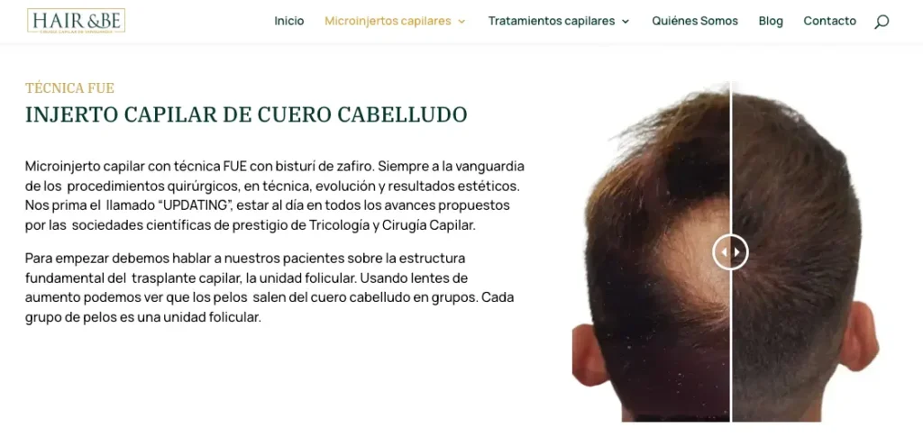 HAIR & BE Clínica de Injerto Capilar Valencia injerto capilar web