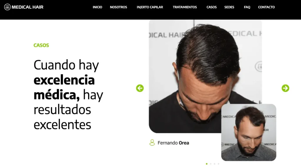 Medical Hair clínica pagina web ejemplo injerto