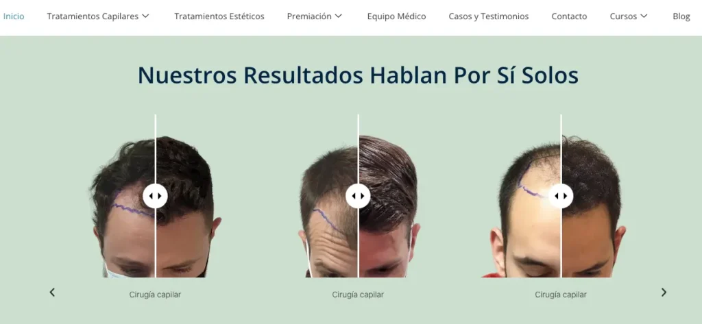 MicroCapilar Hair Clinic pagina web resultados