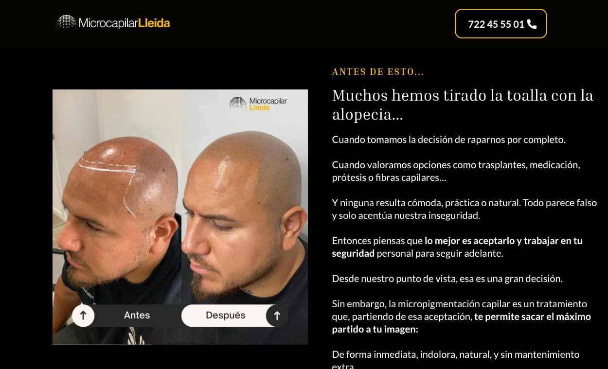 Microcapilar Lleida Micropigmentación Capilar pagina web